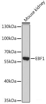 Immunohistochemistry of paraffin-embedded Human breast cancer using ATP2A3 Polyclonal Antibody at dilution of 1:100 (40x lens).
