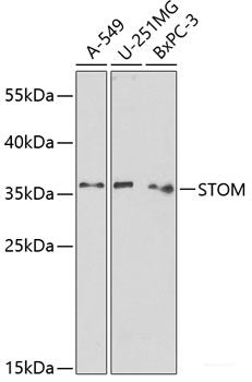Immunohistochemistry of paraffin-embedded Human skin using CDH3 Polyclonal Antibody at dilution of 1:100 (40x lens).