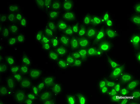 Immunohistochemistry of paraffin-embedded Rat testis using CREBBP Polyclonal Antibody at dilution of 1:100 (40x lens).