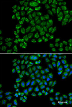 Western blot analysis of extracts of various cell lines using HMGCS2 Polyclonal Antibody at dilution of 1:1000.