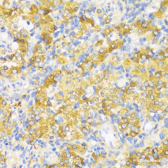 Immunofluorescence analysis of C6 cells using JAG2 Polyclonal Antibody at dilution of 1:100. Blue: DAPI for nuclear staining.