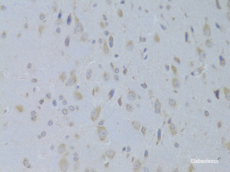 Immunofluorescence analysis of Human colon carcinoma cells using TNFRSF25 Polyclonal Antibody at dilution of 1:100. Blue: DAPI for nuclear staining.