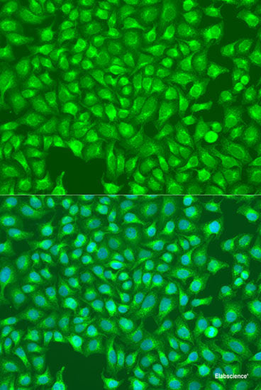 Immunofluorescence analysis of NIH-3T3 cells using VPS26A Polyclonal Antibody at dilution of 1:100 (40x lens). Blue: DAPI for nuclear staining.