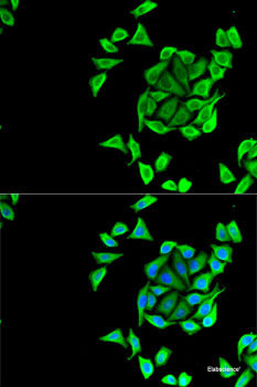 Immunohistochemistry of paraffin-embedded Rat pancreas using DLL1 Polyclonal Antibody at dilution of 1:100 (40x lens).