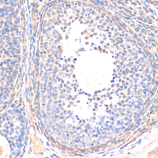 Immunohistochemistry of paraffin-embedded Human lung using CAND1 Polyclonal Antibody at dilution of 1:100 (40x lens).