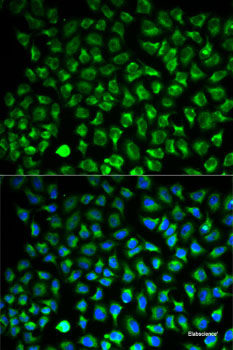 Immunofluorescence analysis of C6 cells using NDUFA4L2 Polyclonal Antibody at dilution of 1:100. Blue: DAPI for nuclear staining.