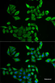 Immunohistochemistry of paraffin-embedded Human colon using CCDC124 Polyclonal Antibody at dilution of 1:100 (40x lens).