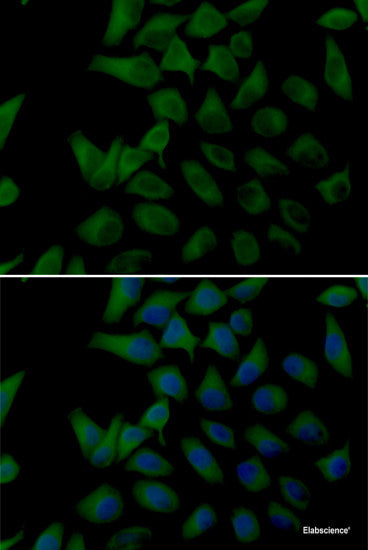 Western blot analysis of extracts of Mouse liver using RBMX2 Polyclonal Antibody at dilution of 1:1000.