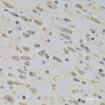 Western blot analysis of extracts of various cell lines using PREPL Polyclonal Antibody at dilution of 1:3000.