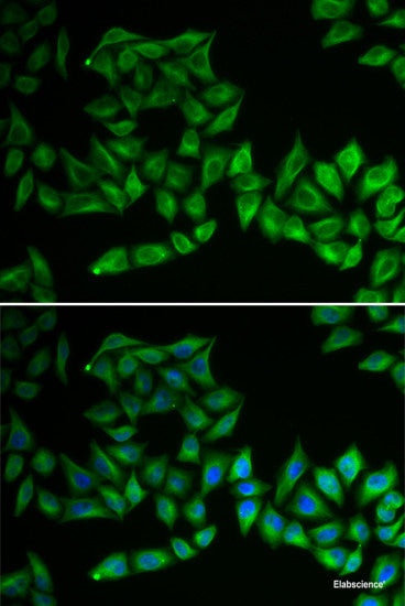 Immunofluorescence analysis of C6 cells using RPL36AL Polyclonal Antibody at dilution of 1:100 (40x lens). Blue: DAPI for nuclear staining.