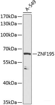 Immunofluorescence analysis of Human placenta using LAIR2 Polyclonal Antibody at dilution of 1:100. Blue: DAPI for nuclear staining.