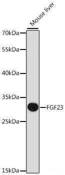 Immunofluorescence analysis of L929 cells using NDUFB3 Polyclonal Antibody at dilution of 1:100 (40x lens). Blue: DAPI for nuclear staining.
