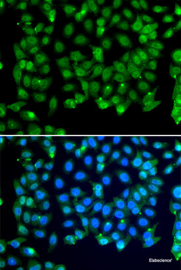Immunohistochemistry of paraffin-embedded Human appendix using ACOT2 Polyclonal Antibody at dilution of 1:100 (40x lens).