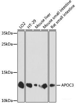 Western blot analysis of extracts of Mouse small intestine using TRIM2 Polyclonal Antibody at dilution of 1:1000.