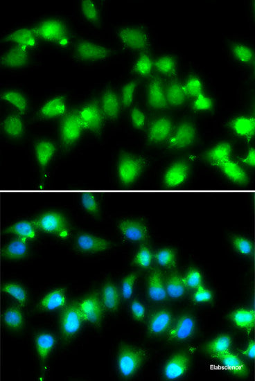 Western blot analysis of extracts of Mouse liver using SYF2 Polyclonal Antibody at dilution of 1:1000.