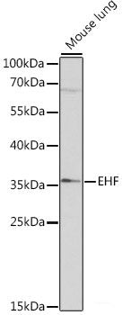 Western blot analysis of extracts of Mouse kidney using ZNF416 Polyclonal Antibody at dilution of 1:1000.