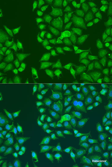 Immunohistochemistry of paraffin-embedded Mouse pancreas using PDP2 Polyclonal Antibody at dilution of 1:100 (40x lens).