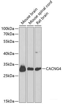 Western blot analysis of extracts of various cell lines using SCRN3 Polyclonal Antibody at dilution of 1:3000.
