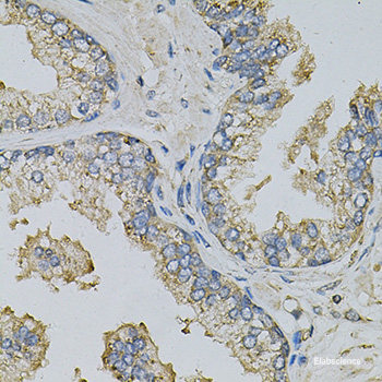 Immunohistochemistry of paraffin-embedded Rat adrenal gland using CYP11B2 Polyclonal Antibody at dilution of 1:100 (40x lens).