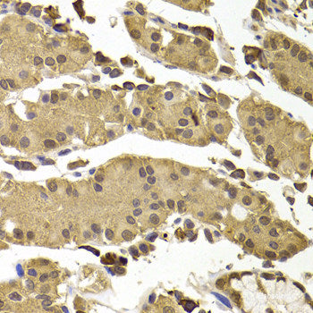 Immunofluorescence analysis of C6 cells using UBQLNL Polyclonal Antibody at dilution of 1:100. Blue: DAPI for nuclear staining.