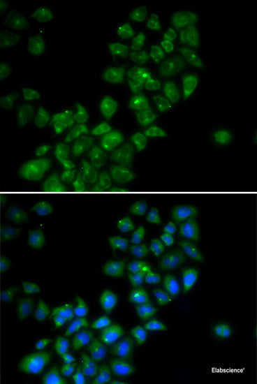 Western blot analysis of extracts of Rat eye using CPLX4 Polyclonal Antibody at dilution of 1:3000.