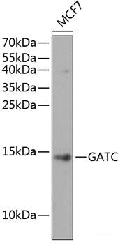 Immunohistochemistry of paraffin-embedded Human appendix using TPSAB1 Polyclonal Antibody at dilution of 1:100 (40x lens).