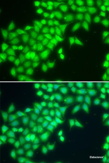 Western blot analysis of extracts of various cell lines using NSA2 Polyclonal Antibody at dilution of 1:1000.