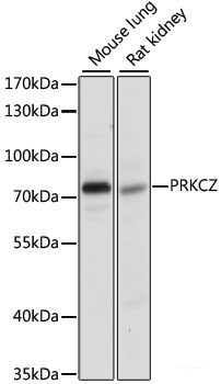 Western blot analysis of extracts of Mouse lung using PEBP4 Polyclonal Antibody at dilution of 1:1000.