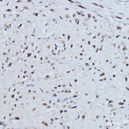 Western blot analysis of extracts of various cell lines using SNCG Polyclonal Antibody at dilution of 1:3000.