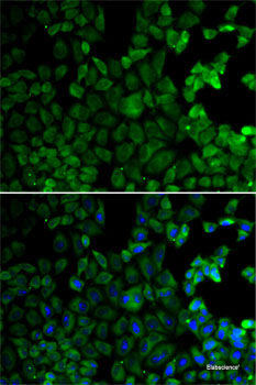 Immunohistochemistry of paraffin-embedded Human stomach using CAMK1 Polyclonal Antibody at dilution of 1:100 (40x lens).