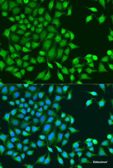 Immunohistochemistry of paraffin-embedded Human stomach using AHR Polyclonal Antibody at dilution of 1:100 (40x lens).