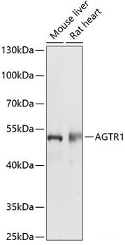 Immunofluorescence analysis of C6 cells using SMYD3 Polyclonal Antibody at dilution of 1:100. Blue: DAPI for nuclear staining.