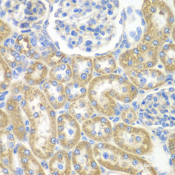 Immunofluorescence analysis of A549 cells using F10 Polyclonal Antibody