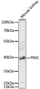 Immunofluorescence analysis of C6 cells using FLCN Polyclonal Antibody at dilution of 1:100. Blue: DAPI for nuclear staining.