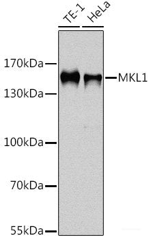 Western blot analysis of extracts of Rat testis using CALM3 Polyclonal Antibody at dilution of 1:3000.