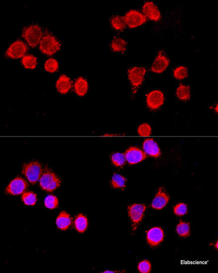 Immunofluorescence analysis of C6 cells using CISH Polyclonal Antibody at dilution of 1:100. Blue: DAPI for nuclear staining.