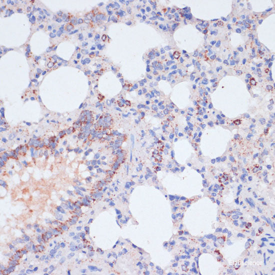 Immunofluorescence analysis of C6 cells using DNASE1 Polyclonal Antibody at dilution of 1:100 (40x lens). Blue: DAPI for nuclear staining.