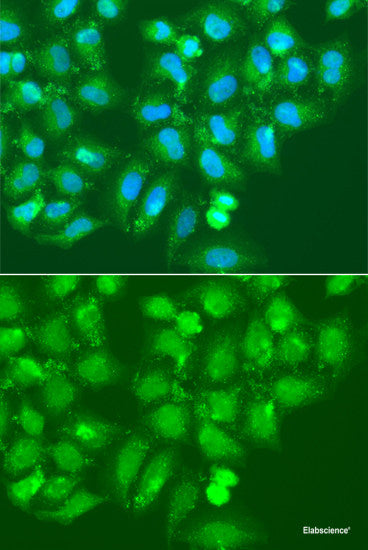 Western blot analysis of extracts of various cell lines using GAB1 Polyclonal Antibody at dilution of 1:1000.