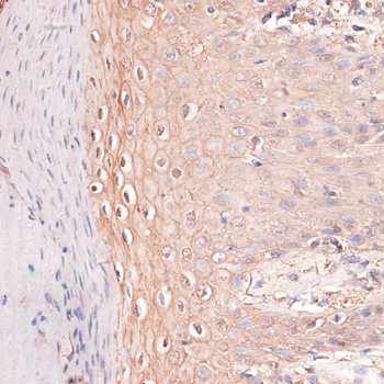 Immunofluorescence analysis of C6 cells using GNAI2 Polyclonal Antibody at dilution of 1:100 (40x lens). Blue: DAPI for nuclear staining.