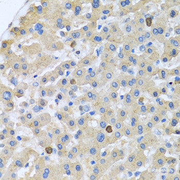 Immunofluorescence analysis of C6 cells using DPP4 Polyclonal Antibody at dilution of 1:100. Blue: DAPI for nuclear staining.