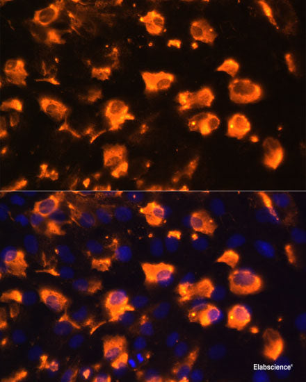 Western blot analysis of extracts of various cell lines using ERCC2 Polyclonal Antibody at dilution of 1:1000.