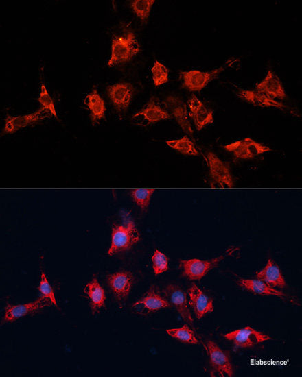 Immunohistochemistry of paraffin-embedded Rat brain using SLC37A4 Polyclonal Antibody at dilution of 1:100 (40x lens).