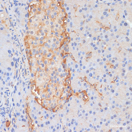 Western blot analysis of extracts of Rat kidney using CORO1B Polyclonal Antibody at dilution of 1:1000.