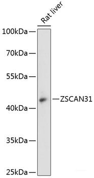 Immunofluorescence analysis of HeLa cells using CCT6B Polyclonal Antibody at dilution of 1:100. Blue: DAPI for nuclear staining.