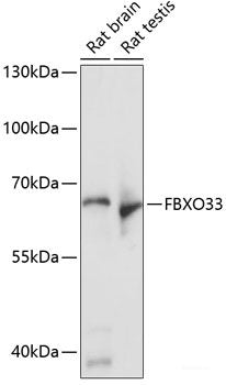 Immunohistochemistry of paraffin-embedded Human colon using CYP2B6 Polyclonal Antibody at dilution of 1:100 (40x lens).