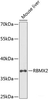 Immunohistochemistry of paraffin-embedded Human stomach using LGALS3 Polyclonal Antibody at dilution of 1:200 (40x lens).
