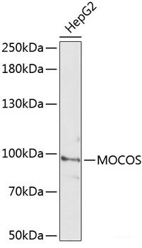 Immunohistochemistry of paraffin-embedded Human liver using SLC19A1 Polyclonal Antibody at dilution of 1:100 (40x lens).