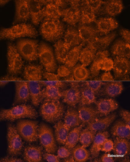 Immunofluorescence analysis of L929 cells using APH1A Polyclonal Antibody at dilution of 1:100 (40x lens). Blue: DAPI for nuclear staining.