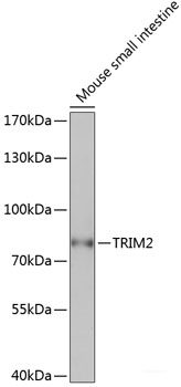 Immunohistochemistry of paraffin-embedded Rat brain using GFAP Polyclonal Antibody at dilution of 1:200 (40x lens).