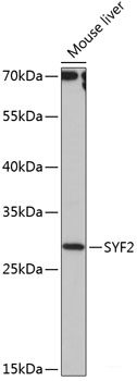 Immunofluorescence analysis of C6 cells using IPO8 Polyclonal Antibody at dilution of 1:100. Blue: DAPI for nuclear staining.